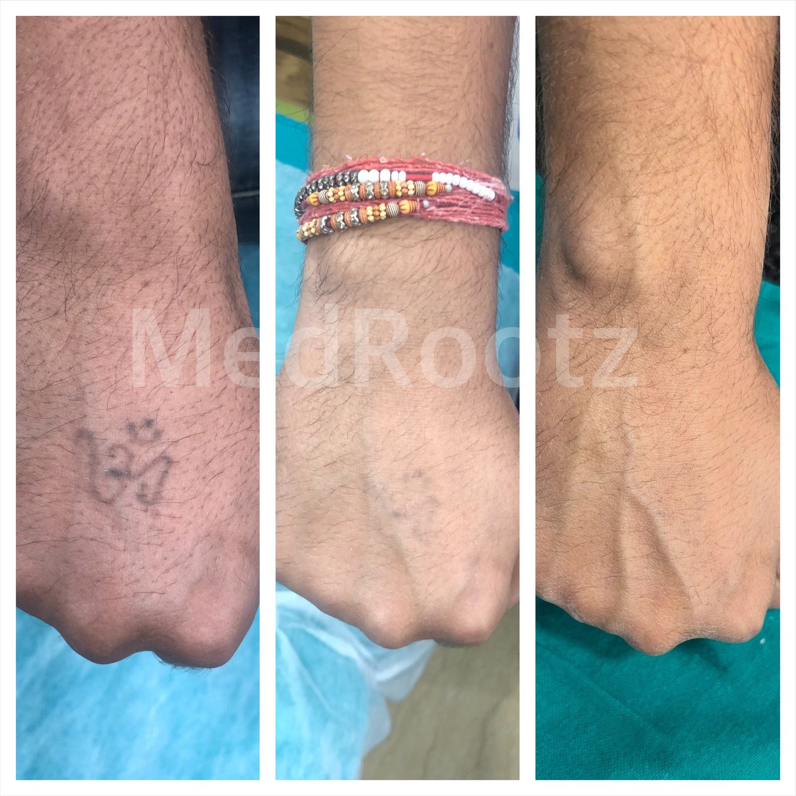Anti-ageing skin treatment at MedRootz